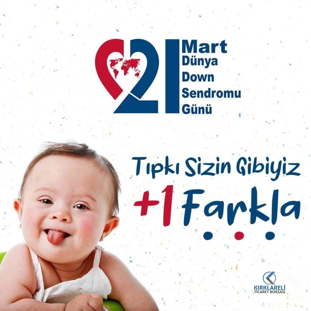 Dünya Down Sendromu Farkındalık Günü